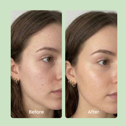 Hypochlorous Acid Cleansing Spray